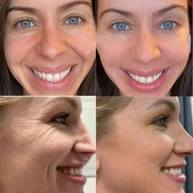 "Embrace Youthful Radiance and Renewed Confidence"